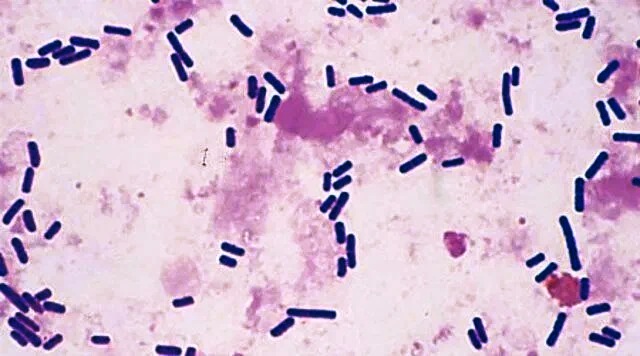 Clostridium perfringens тип C: Причины и последствия